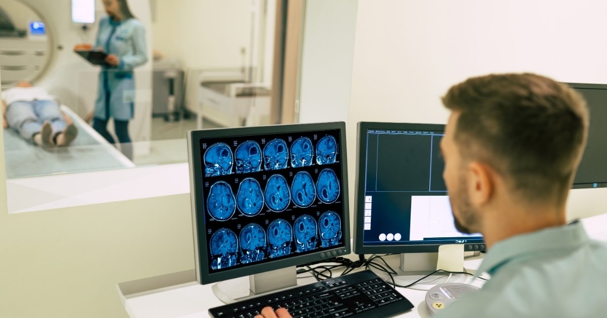 IA identifica avanço do Alzheimer com apenas uma ressonância magnética